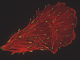 Superresolution Microscopy